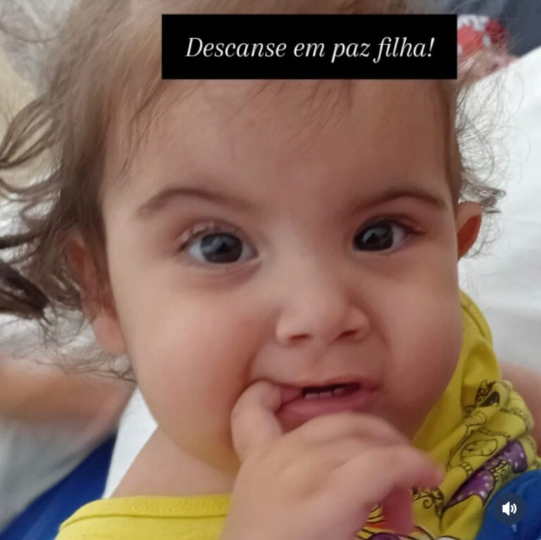 Morre-uma-das-gemeas-siamesas-separadas-em-Goias