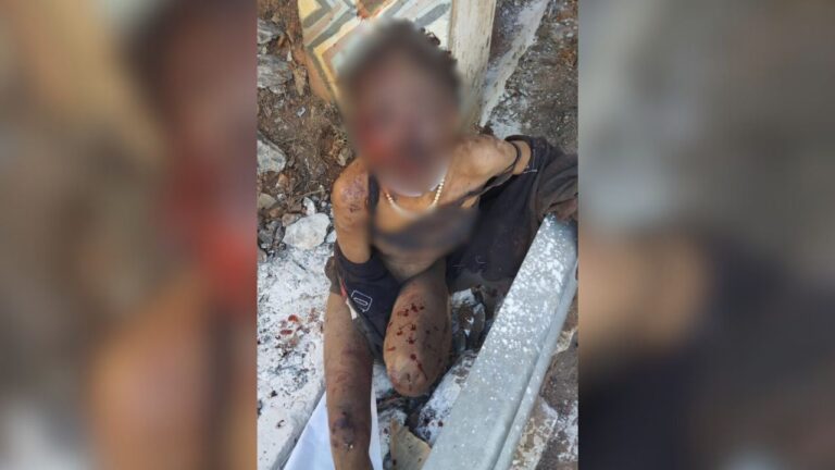 Morador-em-situacao-de-rua-teria-atacado-a-vitima.-Foto-Reproducao